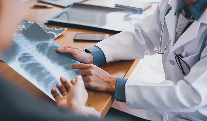 doctor reviewing a lung xray of a worker with an occupational illness