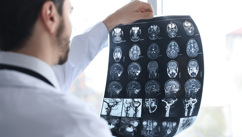 signs of traumatic brain injury